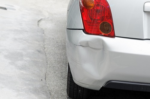 3. へこみの有無